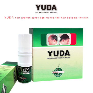 2014 the most demanding product for bald men – Yuda Pilatory hair growing spray; Never gain the same effect in the world
